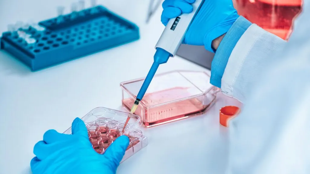 Exámenes de Orina y Heces