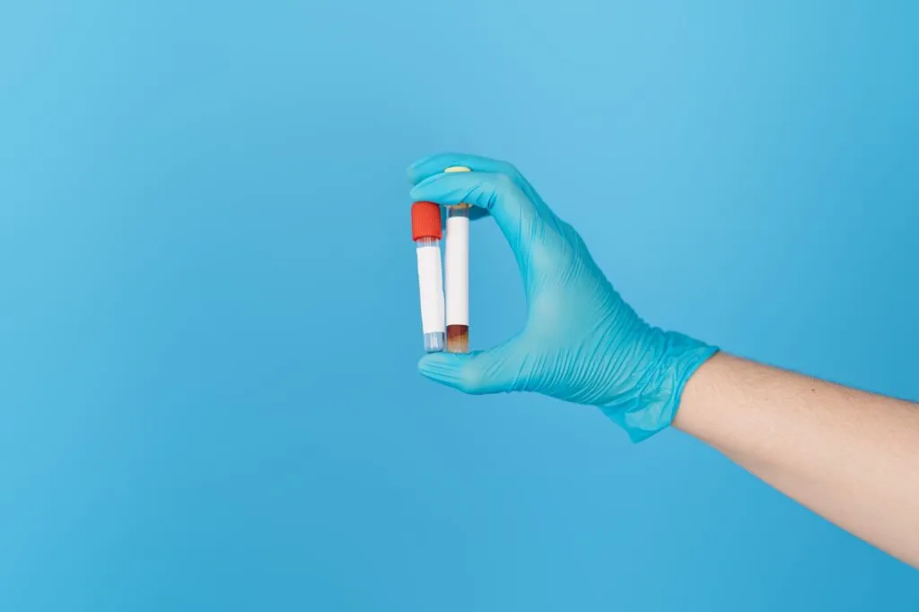 Tubos de ensayo en laboratorio clínico